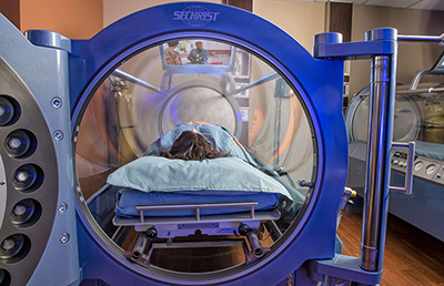 Hyperbaric oxygen chamber