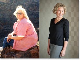 Lynn's weight loss of close to 150 lbs was possible with LAP-BAND bariatric surgery at Community