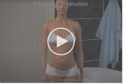 Link to play Understand.com's YouTube breast reconstruction animation