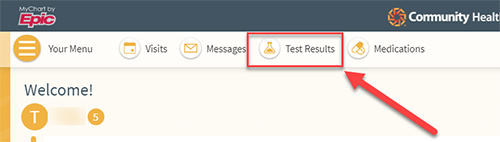 View Test Results menu