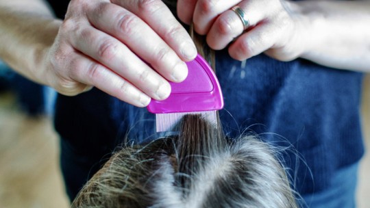 Lice and nit combing