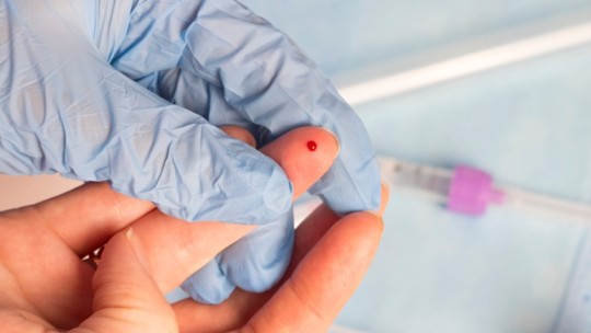 Finger prick HIV blood test 