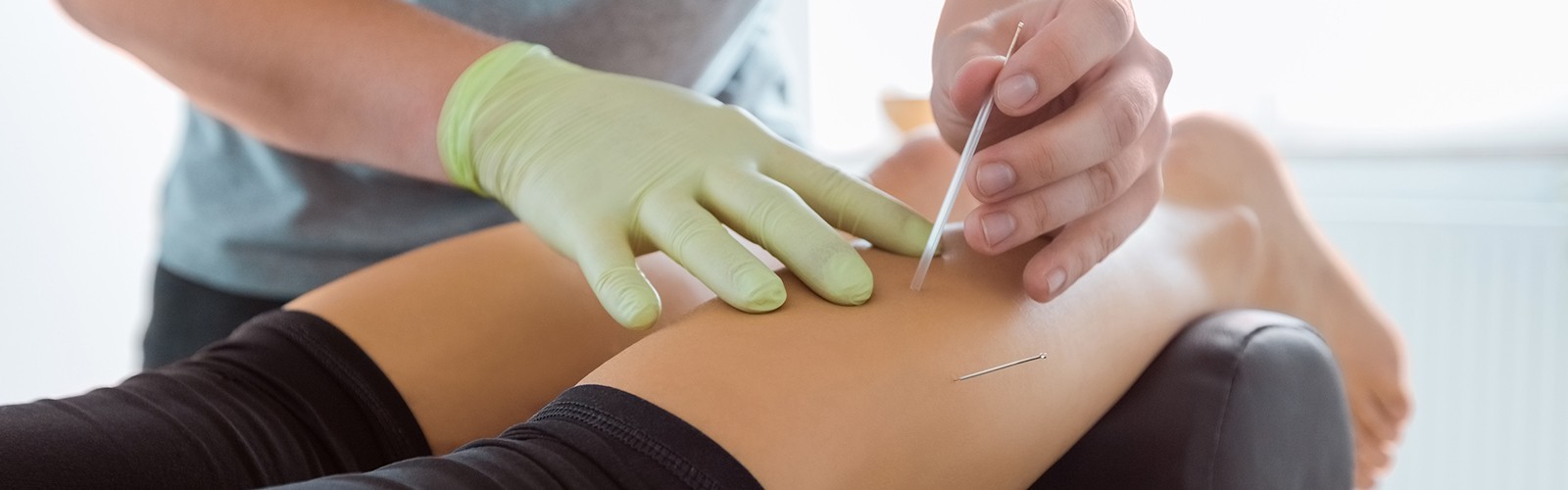 Leg acupuncture procedure