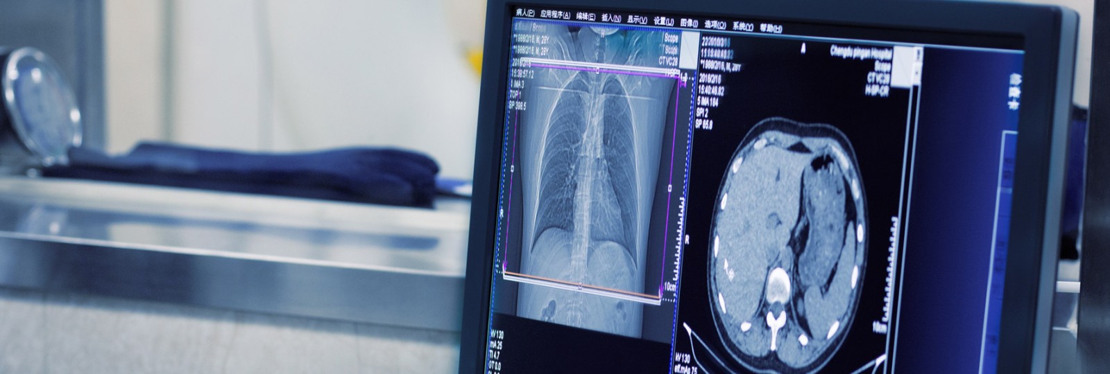 Lung and brain scans on computer screen