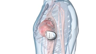 Medtronic Aurora EV-ICD™