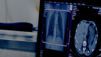 Lung and brain scans on computer screen