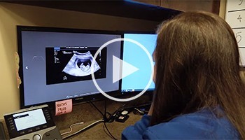 MFM ultrasound tech